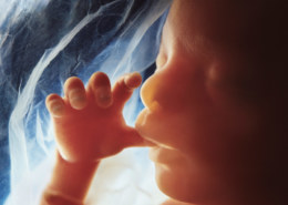 Какие анализы сдают на генетику при беременности ?